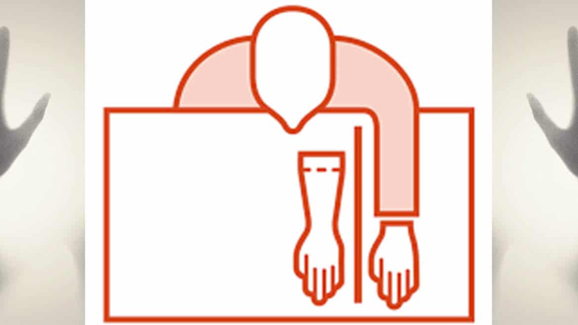 The Rubber Hand Illusion
